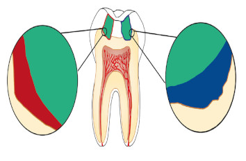 Advances in Dental Materials IR neaSCOPE+s